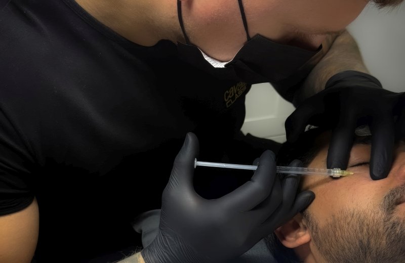 Expert cheek enhancement with dermal fillers in a private clinic
